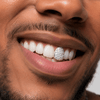 Real Diamonds 925 Sterling Silver Single Cap Custom Grillz (Choose Any Tooth)