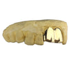 Real Solid 10K Gold Double Front Teeth Custom Grillz