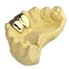Real Solid 10K Gold Double Front Teeth Custom Grillz