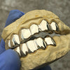 Real Solid 10K Gold Teeth Plain Custom Grillz