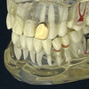 Real Solid 10k Gold Top Single Pre-Made Tooth Cap