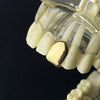 Real Solid 10k Gold Top Single Pre-Made Tooth Cap