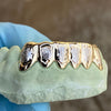 Real Solid 10K Gold Two-Tone Diamond-Dust Custom Grillz