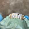 Real Solid 10K Gold Two-Tone Diamond-Dust Custom Grillz