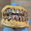 Real Solid 10K Gold Two-Tone Diamond-Dust Custom Grillz