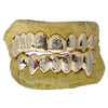 Real Solid 10K Gold Two-Tone Diamond-Dust Custom Grillz