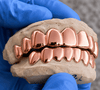 Real Solid 10K Rose Gold Teeth Plain Custom Grillz