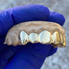 Real Solid 14k Gold Full Diamond-Dust Custom Grillz