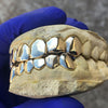 Real Solid 14K Gold  Permanent Look Single Caps Custom Grillz