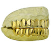 Real Solid 14K Gold Teeth Plain Custom Grillz
