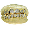 Real Solid 14K Gold Two-Tone Diamond-Dust Custom Grillz