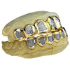 Real Solid 14K Gold Two-Tone Diamond-Dust Custom Grillz
