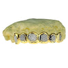 Real Solid 14K Gold Two-Tone Diamond-Dust Custom Grillz