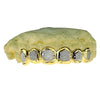 Real Solid 14K Gold Two-Tone Diamond-Dust Custom Grillz