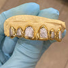 Real Solid 14K Gold Two-Tone Diamond-Dust Custom Grillz