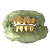 Real Solid 22K Gold Custom Grillz Teeth Grills or Single One Tooth Cap