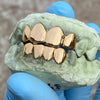 Real Solid 22K Gold Custom Grillz Teeth Grills or Single One Tooth Cap