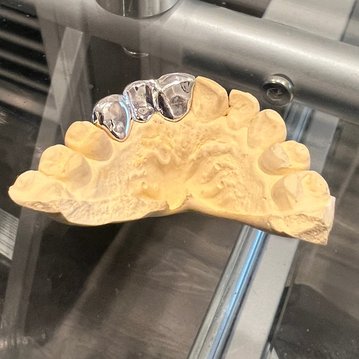 Real Solid 925 Sterling Silver Three Front Teeth Custom Grillz