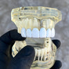 Real Solid 925 Sterling Silver White Enamel Top Six Teeth Grillz