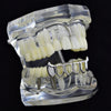 Silver Tone 4 Open Face Bottom Vampire Fang Grillz