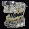 Silver Tone 4 Open Face Top Teeth Vampire Fangs Grillz