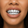 Silver Tone 6 Top and 6 Bottom Teeth Cartel Grillz Set