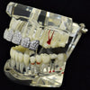 Silver Tone CZ Iced Micro Pave Top Teeth Grillz