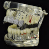 Silver Tone CZ Top Teeth Vampire Fang Grillz