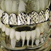 Silver Tone Diamond-Cut Top Teeth Grillz