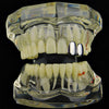 Silver Tone Double Caps Teeth Grillz - Left Hand Side