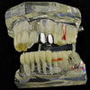 Silver Tone Double Caps Teeth Grillz - Left Hand Side