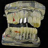 Silver Tone Double Caps Teeth Grillz - Right Hand Side