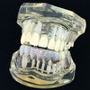 Silver Tone Dust-Cut Bottom Teeth Grillz