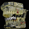 Silver Tone Eight Teeth Bottom Vampire Fangs Grillz