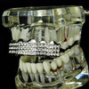 Silver Tone Iced 3 Row Top Teeth Grillz