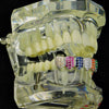 Silver Tone Iced CZ Rainbow Bottom Teeth Grillz