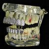 Silver Tone Micro Pave Iced Teeth Grillz Set