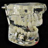 Silver Tone Plain Gap Single Tooth Grillz