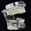 Silver Tone Slim Bar Bottom Vampire Fangs Teeth Grillz