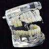 Silver Tone Slim Bar Top Half Vampire Fangs Grillz