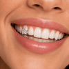 Silver Tone Star Open Face Canine Cap One Tooth Single Grillz