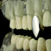 Silver Tone Vampire Fang Top Canine Tooth Cap