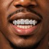 Silver Tone Vampire Fangs Top Teeth CZ Iced Blinged Out Grillz