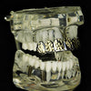 Silver Tone with Gold Diamond Cut Top Teeth Grillz