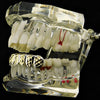 Silver Tone with w/14K Gold Plated Diamond-Cuts Bottom Teeth Grillz