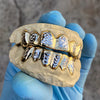 Solid 14K Gold Two-Tone Diamond-Cut Custom Grillz