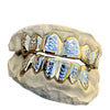 Solid 14K Gold Two-Tone Diamond-Cut Custom Grillz