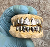 Solid 14K Gold Two-Tone Diamond-Cut Custom Grillz