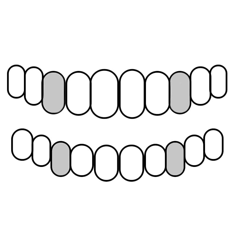 925 Sterling Silver Custom Canine Tooth Caps Teeth Grillz Set