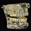 Two-Tone Premium CZ Iced Micro Pave Teeth Grillz Set